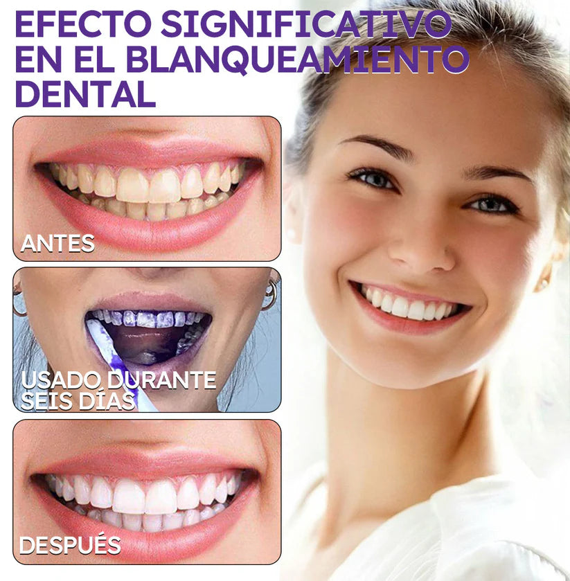 Blanqueador Dental V34 - ¿Dientes amarillos y encías inflamadas? lo soluciona + Regalos Exclussivos