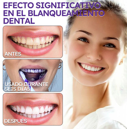Blanqueador Dental V34 - ¿Dientes amarillos y encías inflamadas? lo soluciona + Regalos Exclussivos